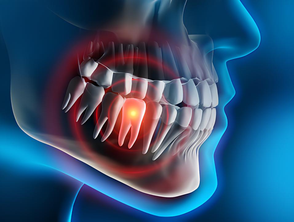 Teeth image - Emergency dentist Fleet